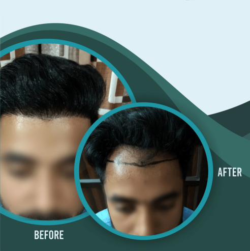 Trusted by experts in Hair Loss Treatment