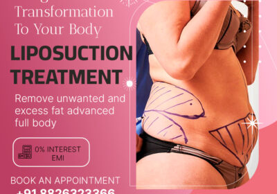 Dr. Sahil Singla: The Best Liposuction Surgeon in Delhi for Exceptional Results